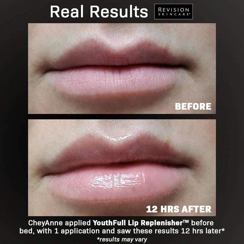 Revision Skincare YouthFull Lip Replenisher