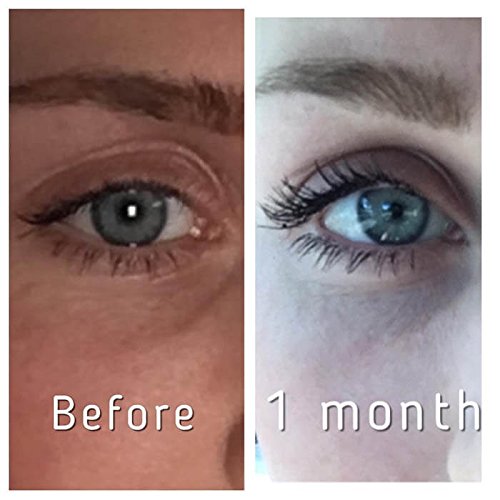 Hairgenics Lavish Lash – Eyelash Growth Enhancer & Brow Serum with Biotin & Natural Growth Peptides for Long, Thick Lashes and Eyebrows! Dermatologist Certified, Cruelty Free & Hypoallergenic.
