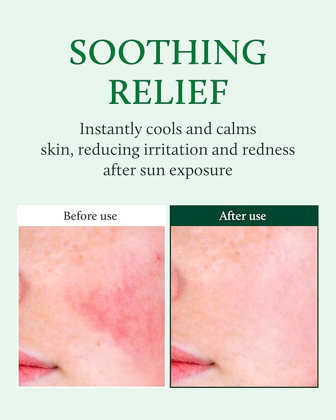 YADAH Cactus Soothing Gel (8.45fl oz) - Sunburn Relief, Calm, Cool & Soothe Irritated Skin, Face Redness. Korean Skin Care. 95% Cactus Extract, Vegan.