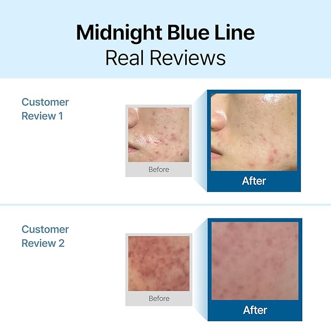 DearKlairs Midnight Blue Calming Cream – Soothing Face Moisturizer for Oily & Sensitive Skin, Redness Relief & Hydrating, Lightweight Texture, 1.01 Fl Oz