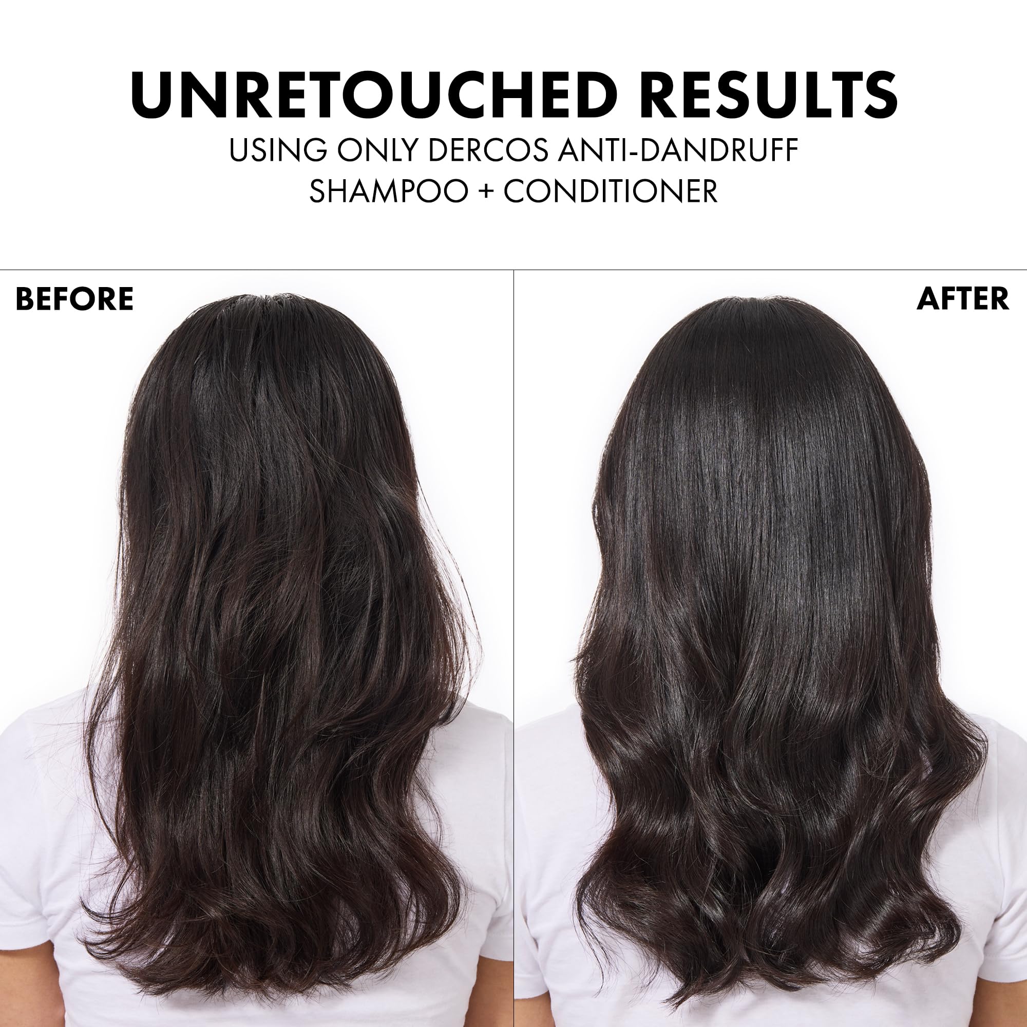 Vichy Dercos Neogenic Shampoo - Hair Thickening & Volumizing Shampoo for Thinning Hair, 13.53 fl oz