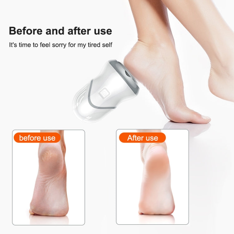 Electric Vacuum Design Foot Grinder Household Multifunctional Pedicure Calluses Foot Care, Specification:Silver Foot Grinder
