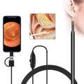 i95 3 in 1 USB Ear Scope Inspection HD 0.3MP Camera Visual Ear Spoon for OTG Android Phones & PC & MacBook, 1.75m Length Cable (Black)