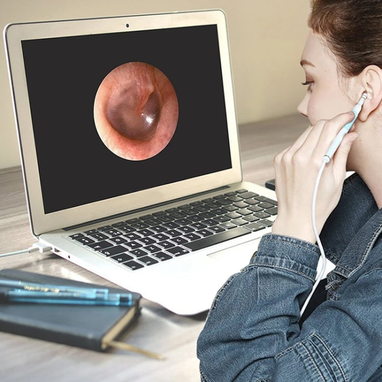 i95 3 in 1 USB Ear Scope Inspection HD 0.3MP Camera Visual Ear Spoon for OTG Android Phones & PC & MacBook, 1.75m Length Cable (Pink + White)