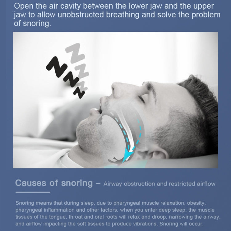 YJK100 Silicone + ABS Stop Snoring Device Anti Snore (White)