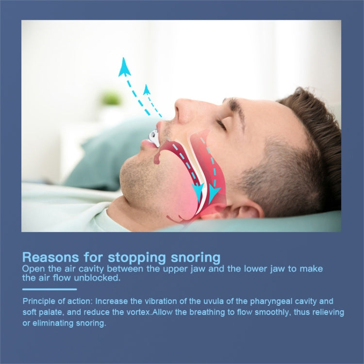 YJK100 Silicone + ABS Stop Snoring Device Anti Snore (White)