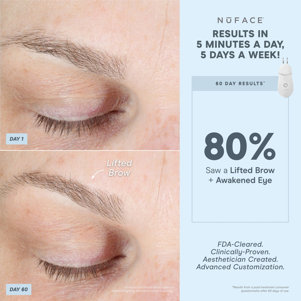 TRINITY+ Effective Lip & Eye Attachment | NuFACE