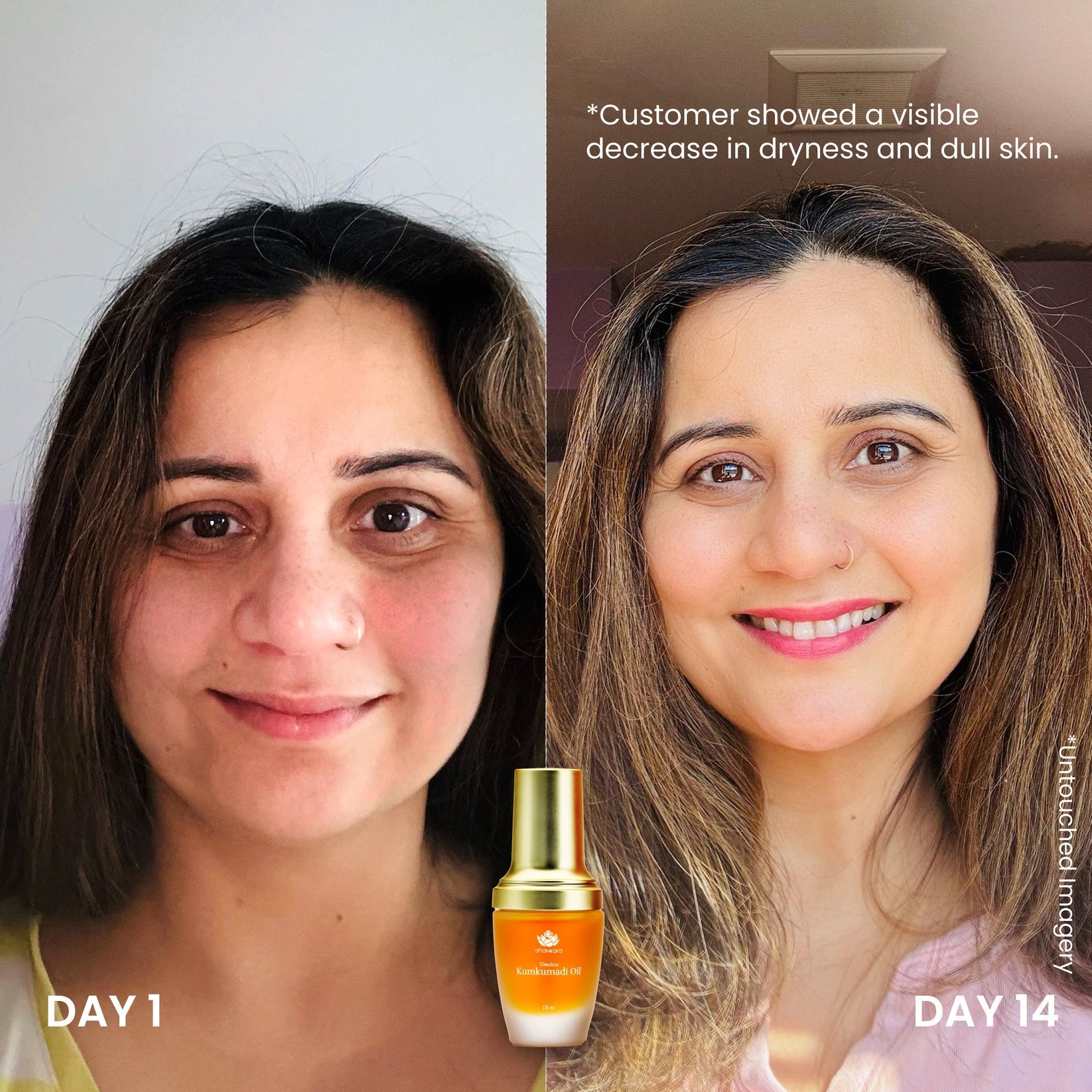 Timeless Kumkumadi Oil | Shankara