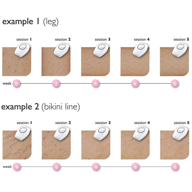 Aimanfun 100000 Flash Professional IPL Epilator Laser Hair Removal Women Painless Threading Hair Remover Machine(AU Plug)