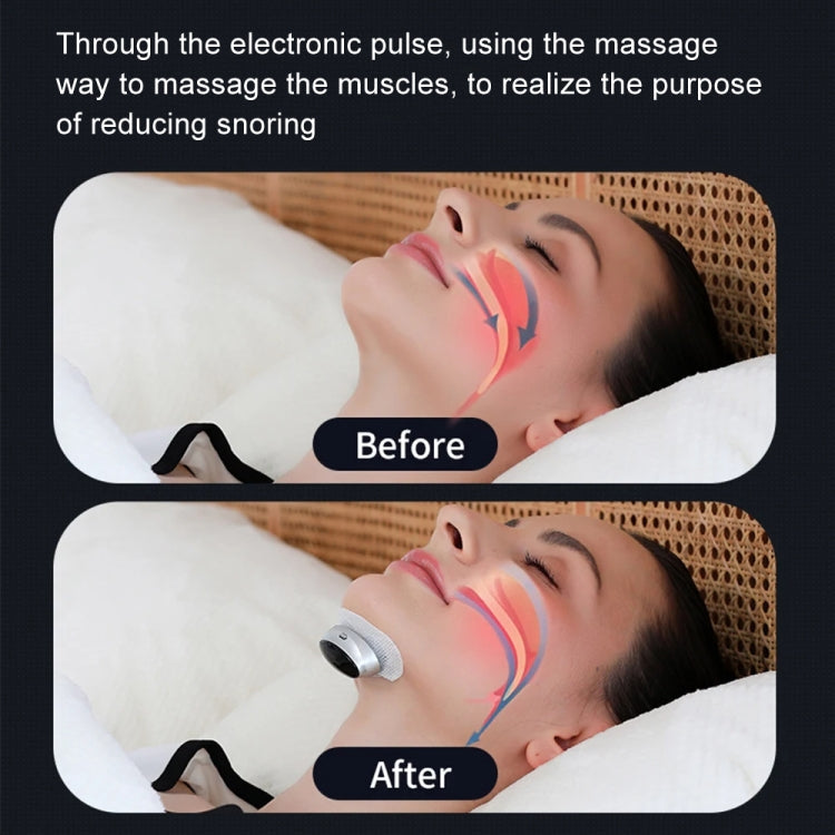 Smart Anti-snoring Device TENS Double Pulse Sound Wave Induction Sleep Snoring Breathing Corrector(Black)