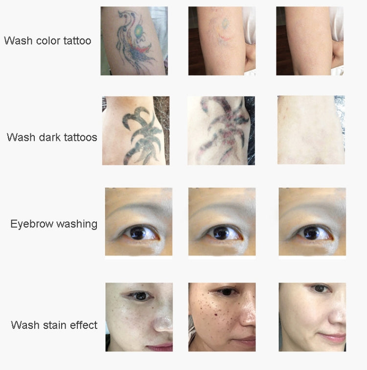 Laser Tattoo Removal Machine Non-invasive Eyebrow Washing Beauty Equipment(AU Plug)