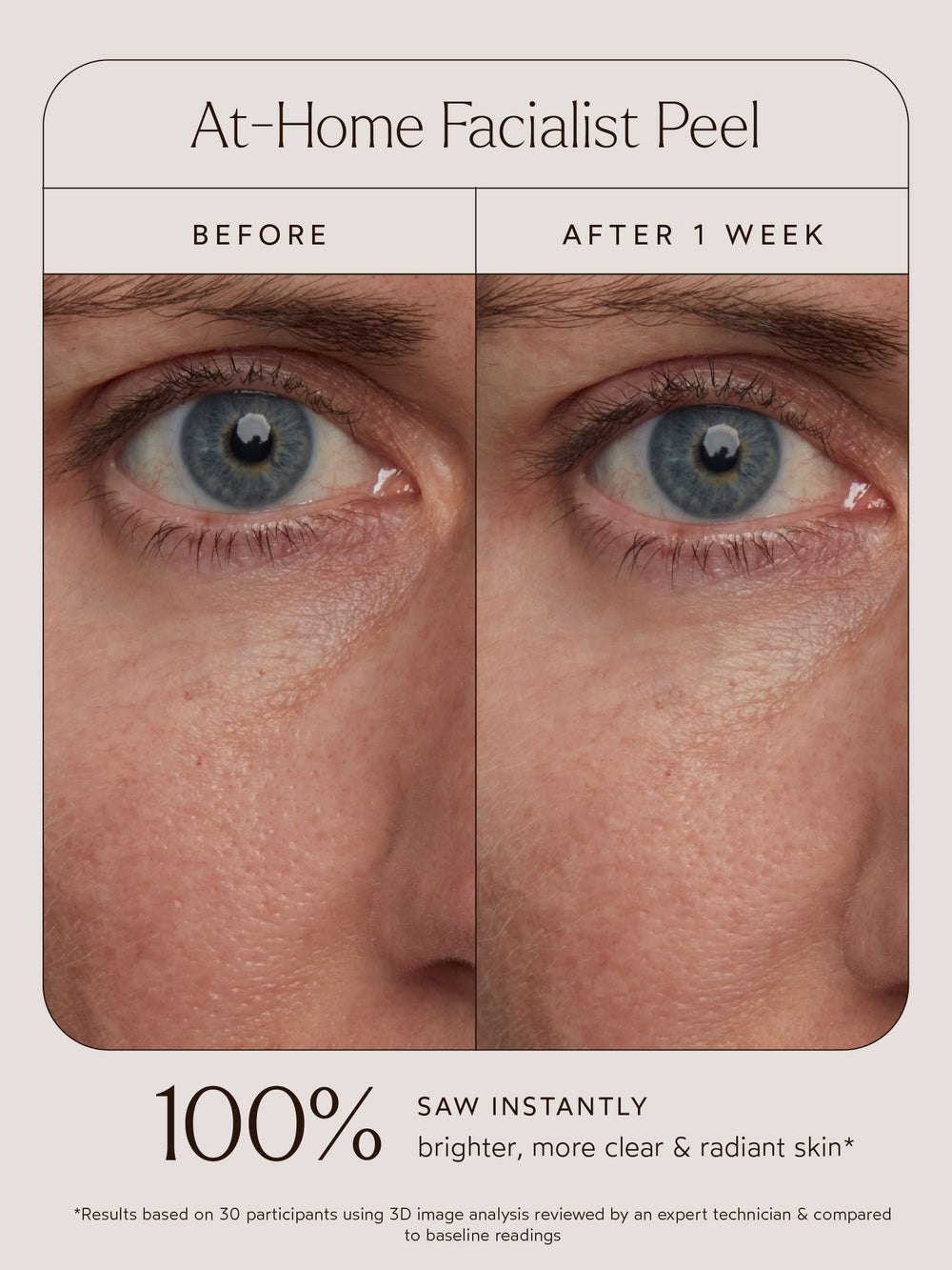 At-Home Facialist Peel | True Botanicals