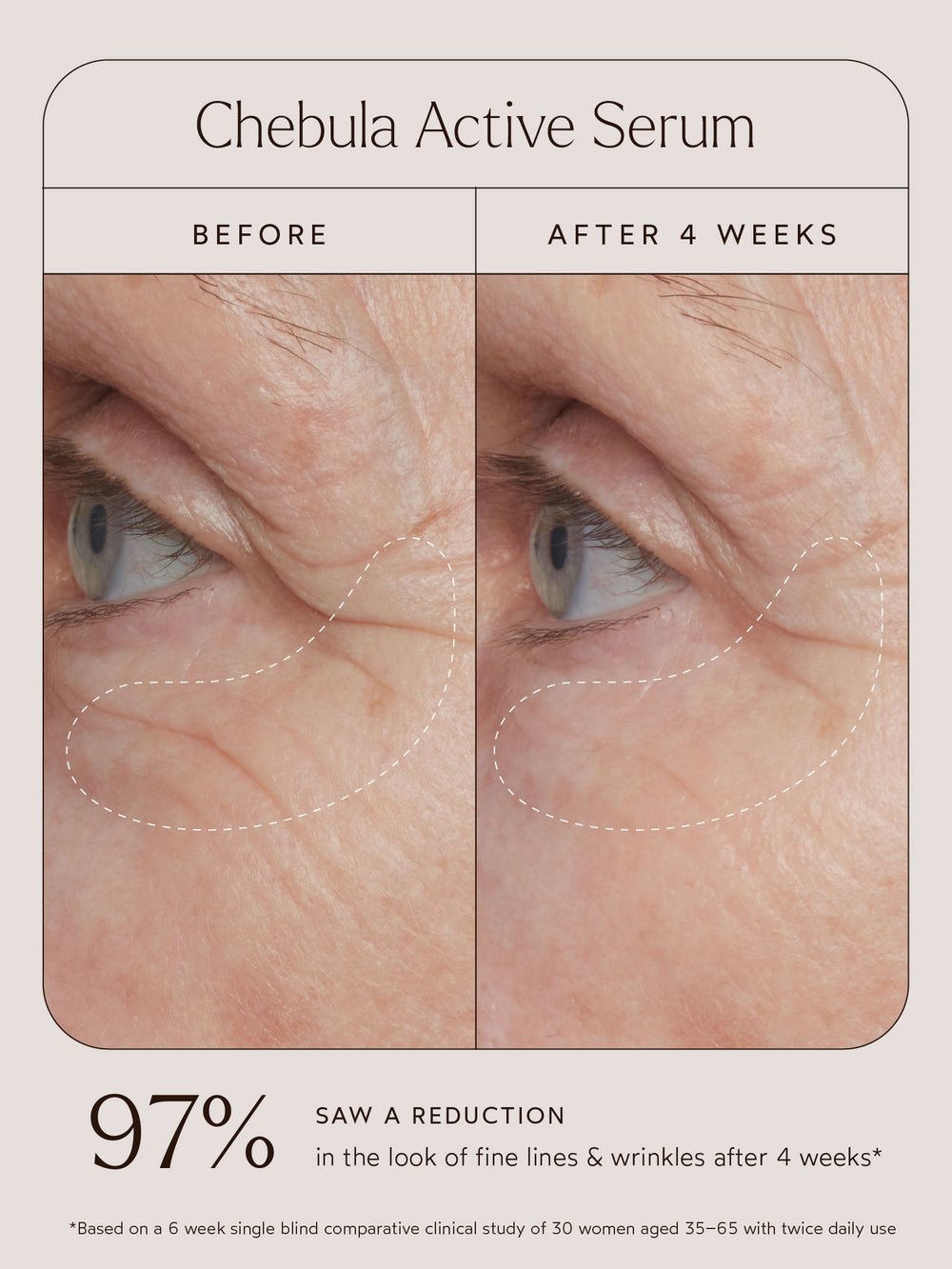 Chebula Active Serum | True Botanicals