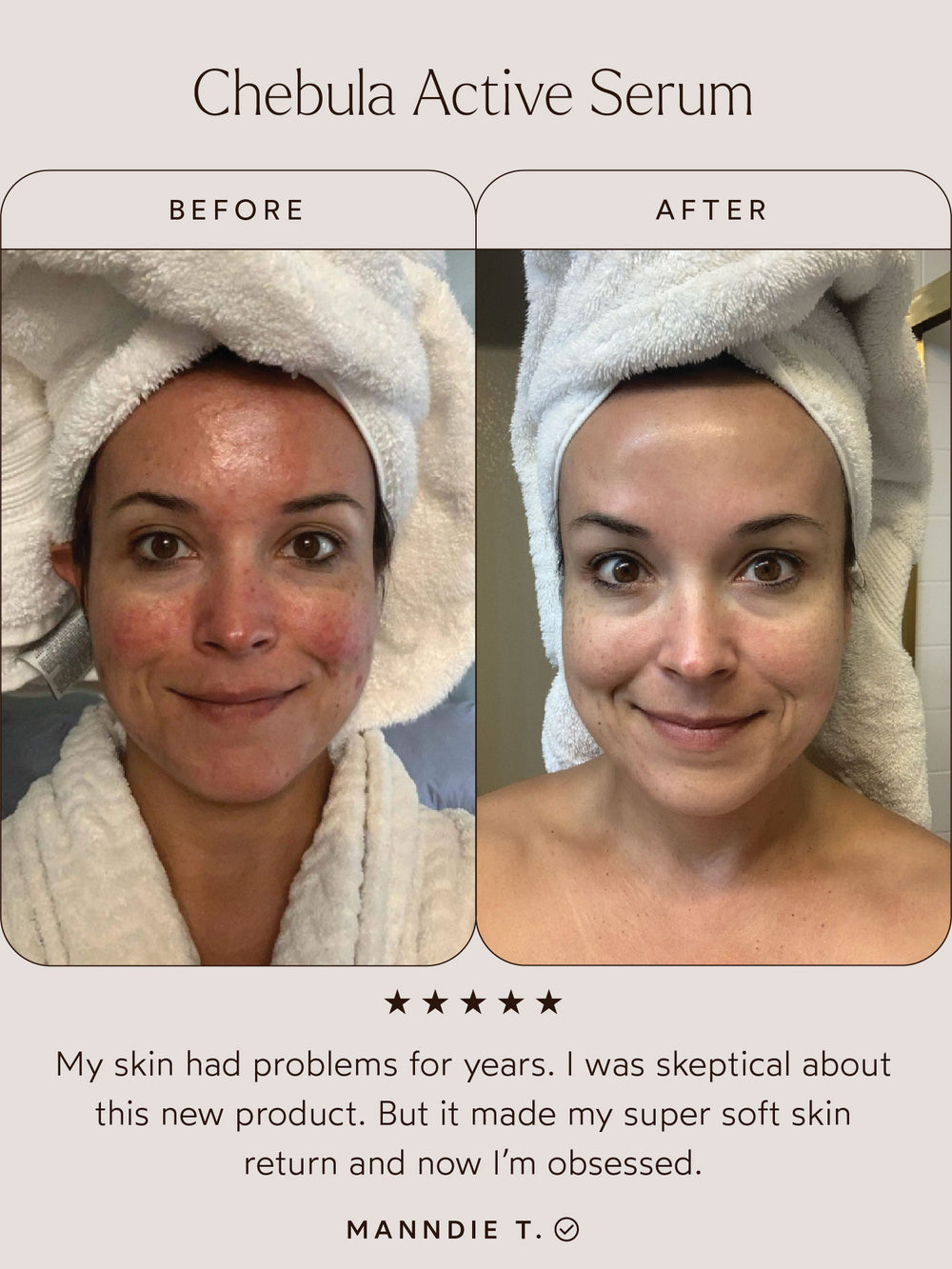 Chebula Active Serum | True Botanicals