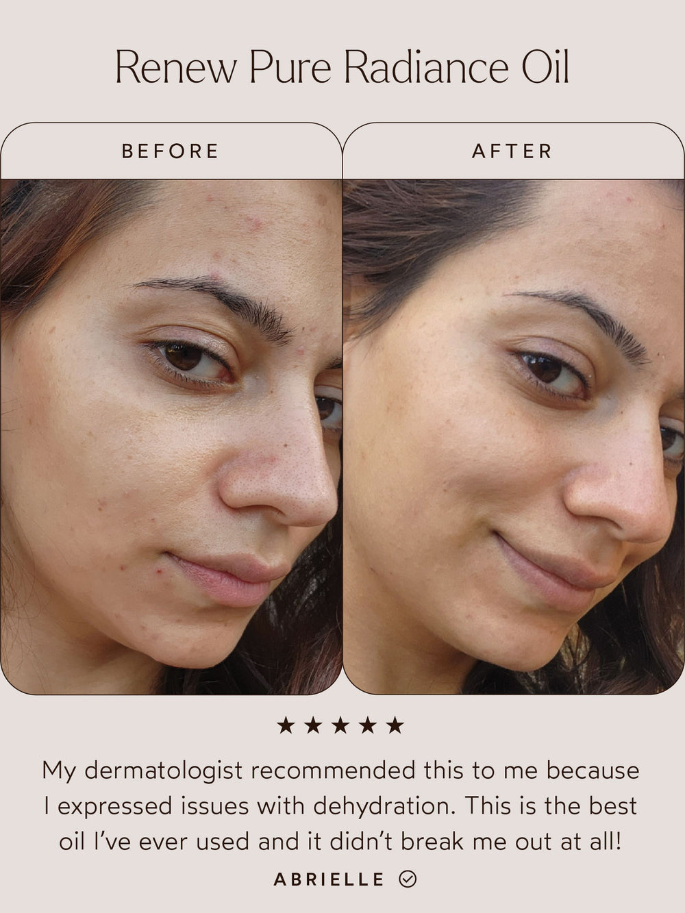 Renew Pure Radiance Oil | True Botanicals