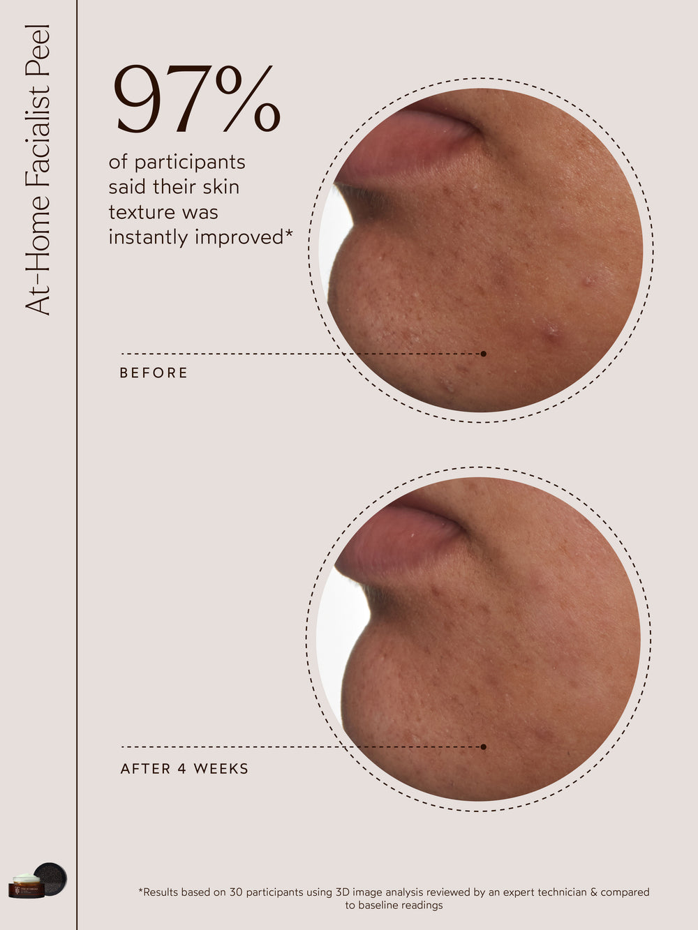 At-Home Facialist Peel | True Botanicals