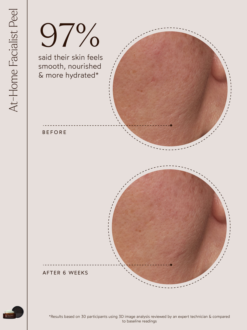 At-Home Facialist Peel | True Botanicals