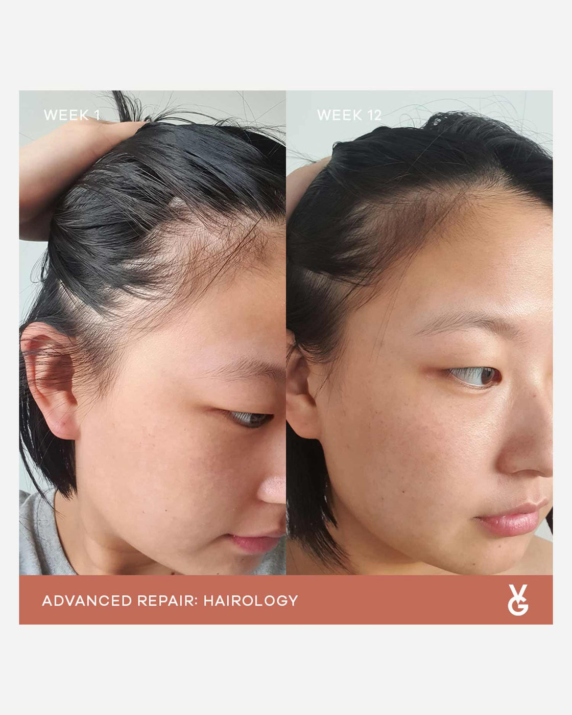 Hairology Capsules | VIDA GLOW