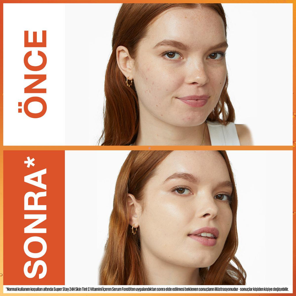 Maybelline Super Stay Skin Tint Foundation: Vitamin C, 24H Wear, Hydrating, Brightening - Natural Finish Skin Tint