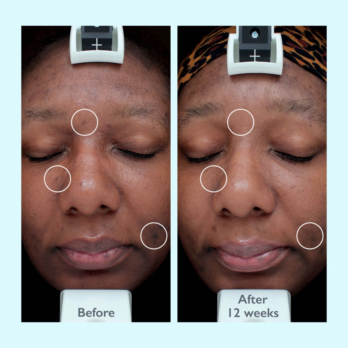 Restorsea PRO Intensive Treatment 10X - Face Serum