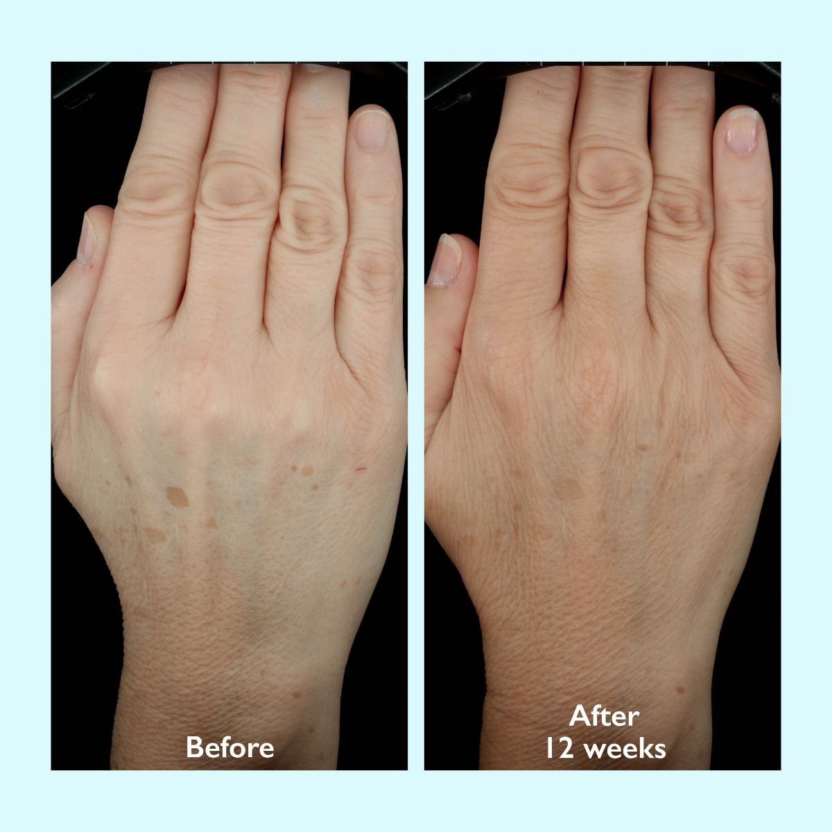 Restorsea PRO Intensive Treatment 10X - Hand Cream