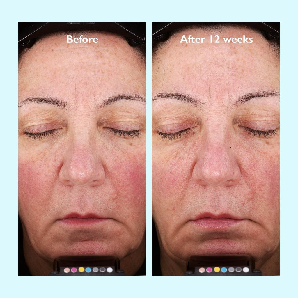 Restorsea PRO Rebalancing Lotion
