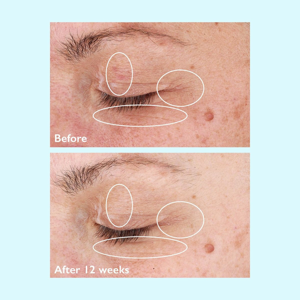Restorsea Revitalizing Eye Cream