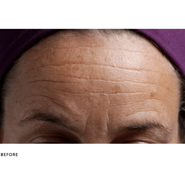 SilcSkin Brow Pads