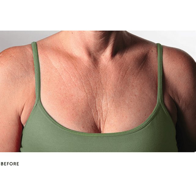 SilcSkin Decollette Pad