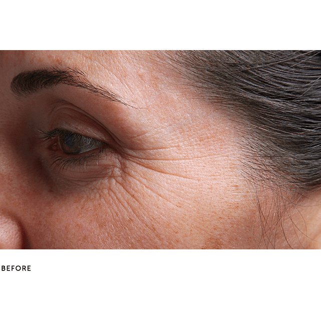 SilcSkin Eye Pads