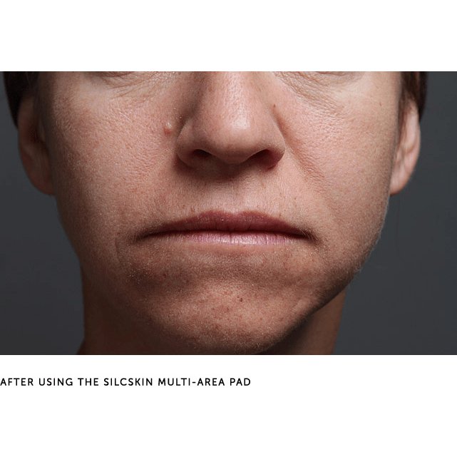 SilcSkin Multi-Area Facial Pads