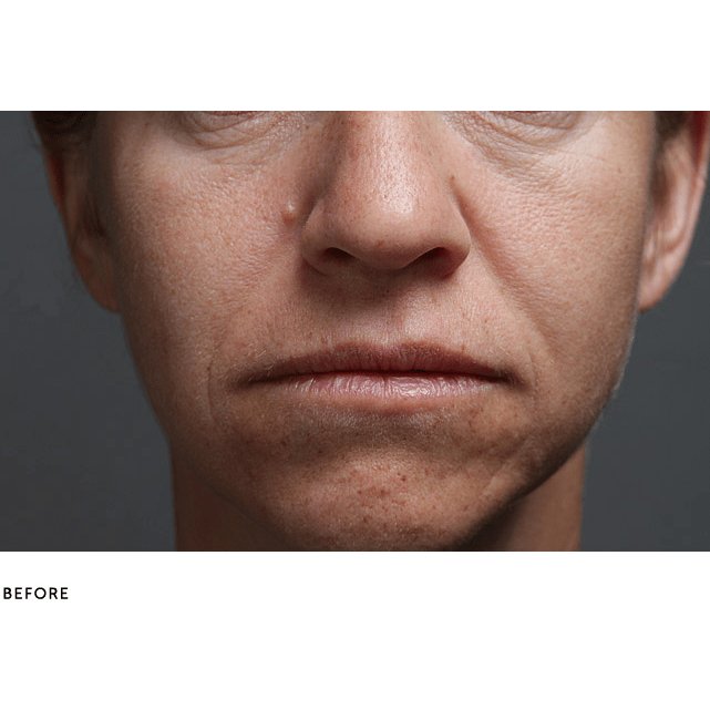 SilcSkin Multi-Area Facial Pads